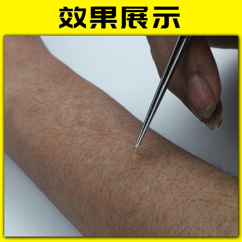 极速掏挖抠耳朵专用镊子夹耳屎儿童安全发光耳勺专业采耳夹子陶耳