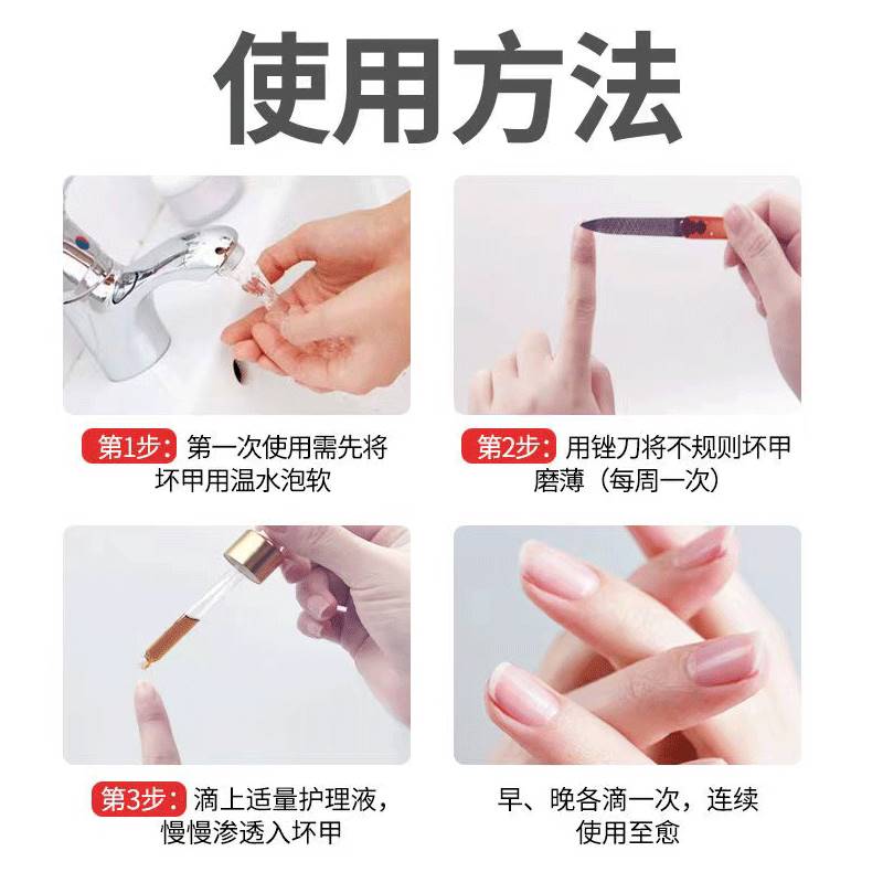 好货增厚/变色/粉末/掉渣/凹凸不平/甲沟美甲修复滴液指甲受损再