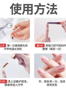 好货增厚/变色/粉末/掉渣/凹凸不平/甲沟美甲修复滴液指甲受损再