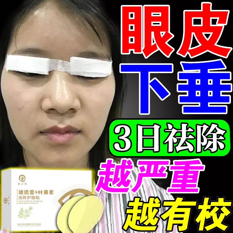 好货防上眼皮下垂提拉贴去肿眼泡消除脂肪眼皮松弛提拉紧致双眼皮