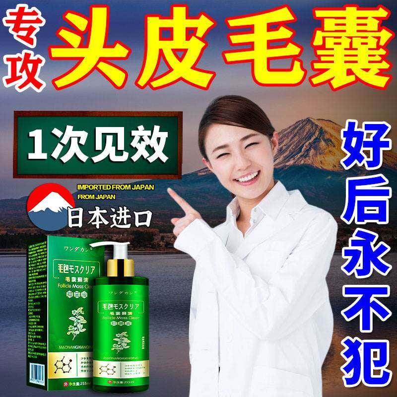 现货速发头皮头部脂溢性皮炎头上长痘痘除蟎头痒有疙瘩药