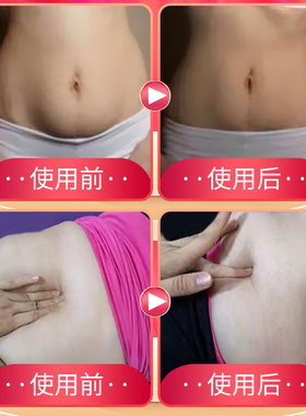 极速腹直肌分离修复贴产后收腹家用仪器训练锻炼器缩腹Y直肌阴大