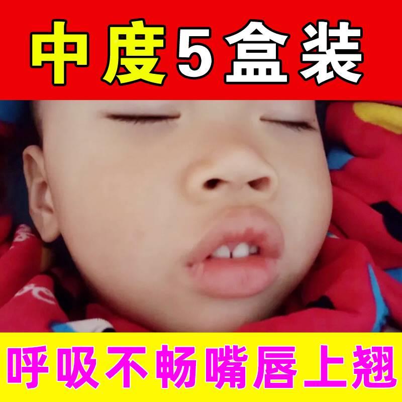 极速销品腺样体肥大m童宝宝睡觉鼻塞张嘴呼吸不通气面容矫正器贴