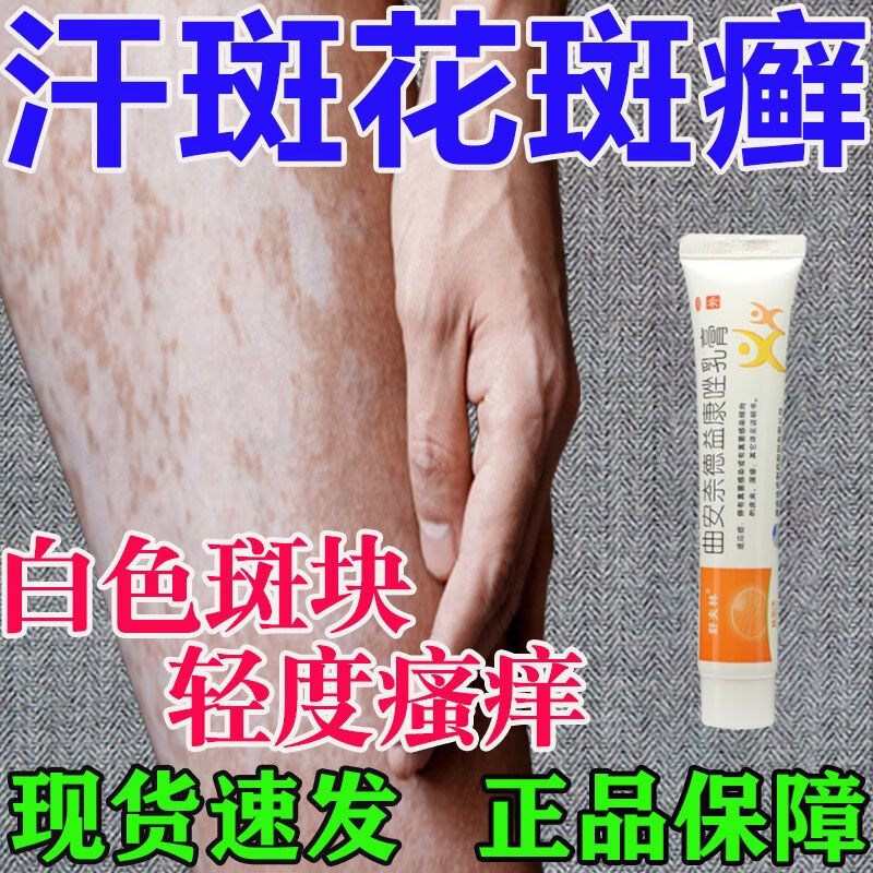 汗斑花斑癣专用药膏治疗汗斑的药腋下汗斑多真菌感染体癣铜钱癣药