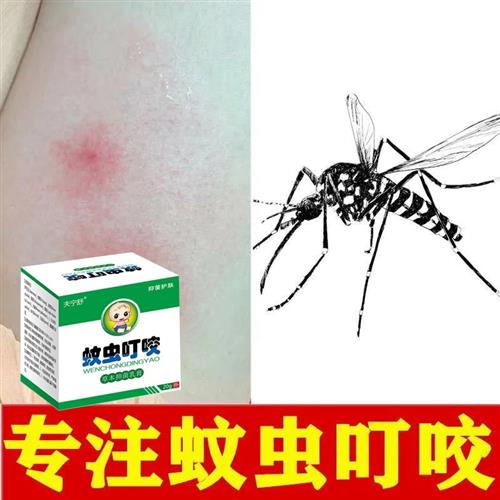 极速被蚊虫跳蚤咬止痒膏毒虫红蚂蚁咬伤过K敏臭虫螨虫蚊子叮咬止