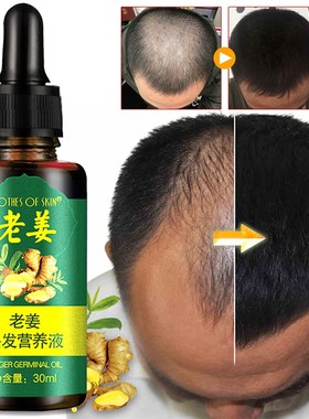 极速7 Days Ginger Essence Hair Essential Oil HQair Care Oil
