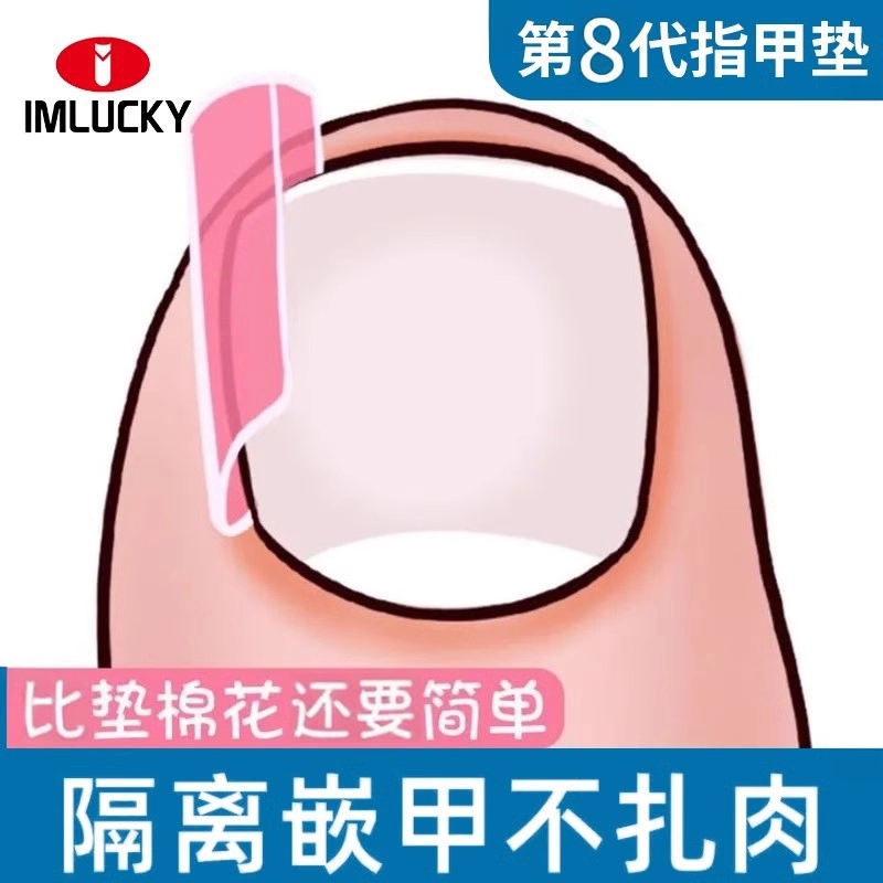 【无感隔离】指甲矫正器嵌甲专用