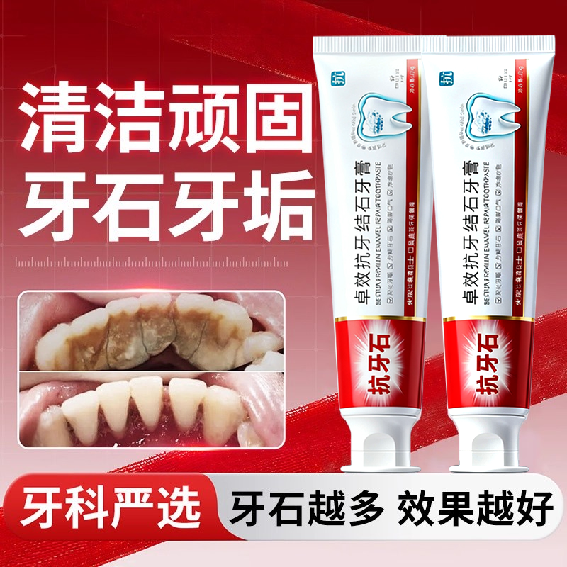 【医研级】1OO%去牙结石口臭牙膏