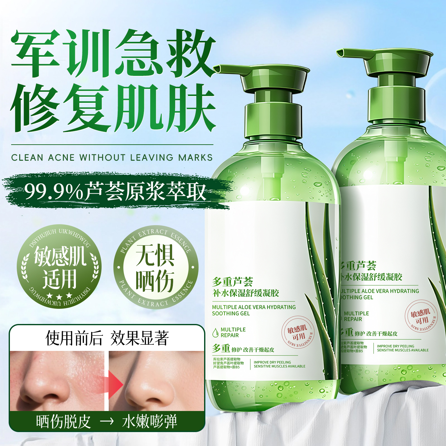 全网热销1OOW丨军训修护芦荟胶