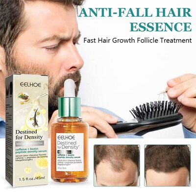 极速45ml Hair Regrowth Oil Moisturizing Hair NutriUent Solut