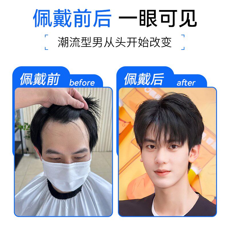 新品男士假发短发头顶补发全手织夏天H薄款无痕隐形全真人发秃顶