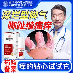 脚趾缝瘙痒去糜烂性型专用脚气烂脚膏脱皮止真菌感染痒癣OA
