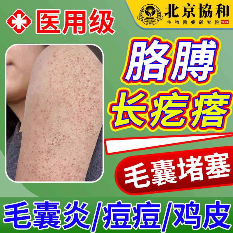 手臂毛囊炎胳膊上长疙瘩去鸡皮肤毛孔堵塞疏通毛囊特的小疙瘩效oa
