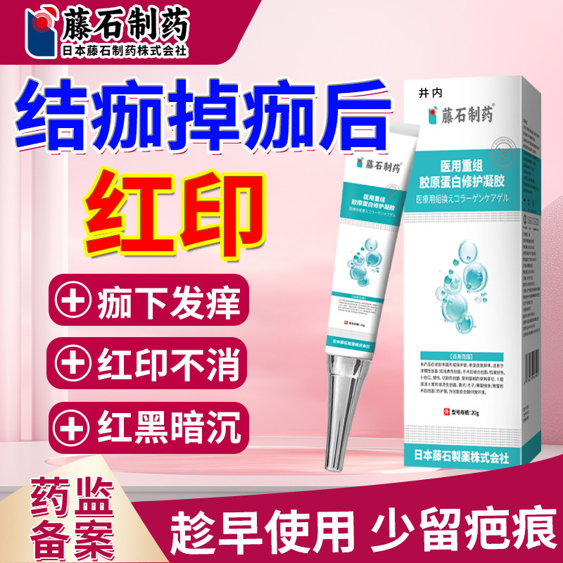 掉痂后红印去白疤黑印点痣疤痕修退红复凝胶淡色素疤印儿童可用OA