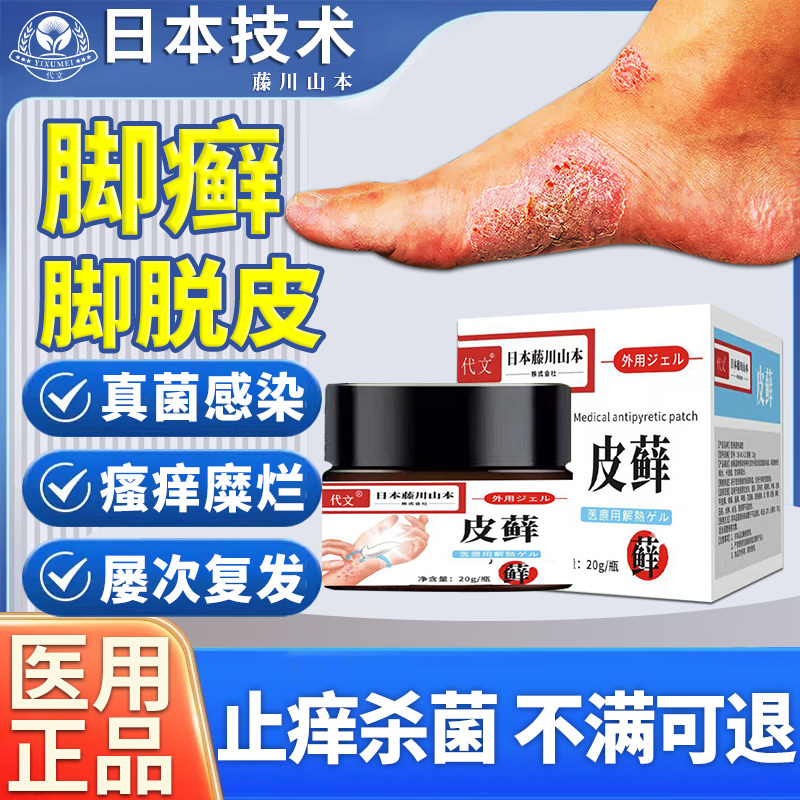 足癣脚癣一次净膏真菌感染脚气脚止痒治疗脱皮水泡型泡脚干裂ir