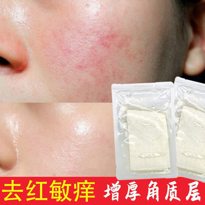 敏感肌补水修复面膜美容院激光术后红痒激素脸增厚角质层修复面膜
