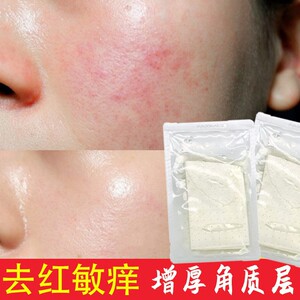 敏感肌补水修复面膜美容院激光术后红痒激素脸增厚角质层修复面膜
