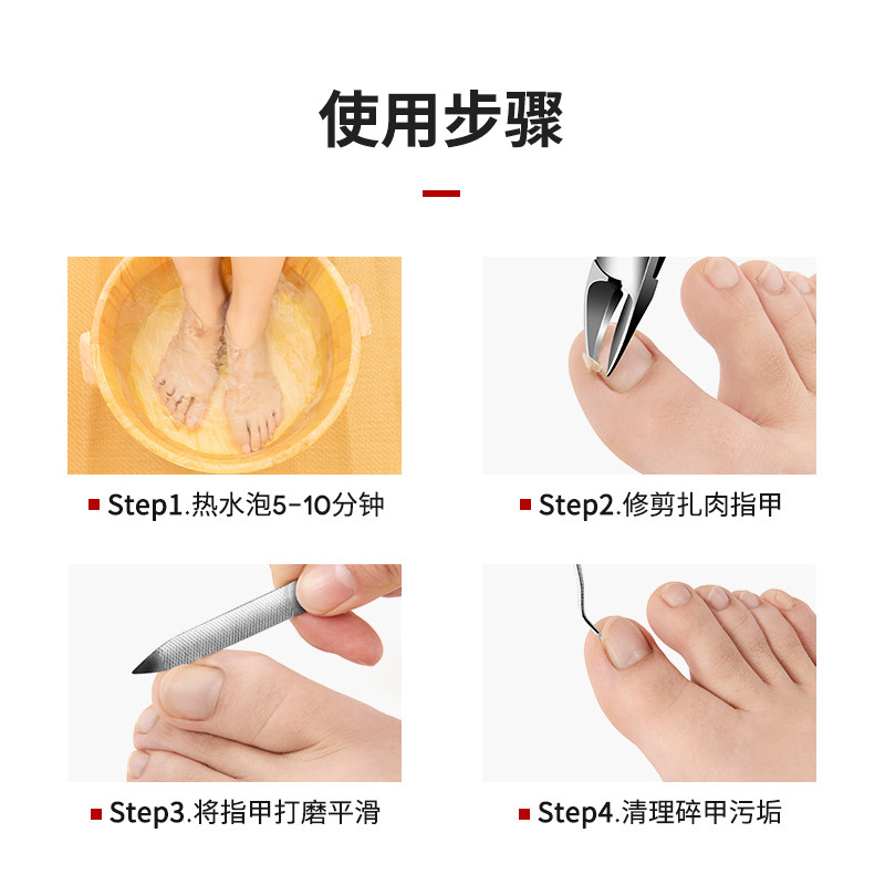 热销修脚神器甲沟炎指甲r刀套装指甲钳指甲剪钳子 尖嘴 修脚家用