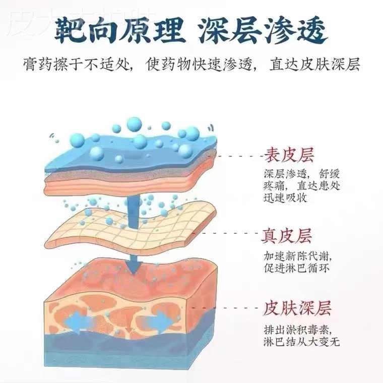 新品去副乳消g除贴淋巴结消散膏散结通络疏通颈部肿大腋下窝结节