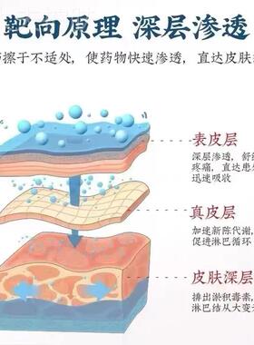 新品去副乳消g除贴淋巴结消散膏散结通络疏通颈部肿大腋下窝结节