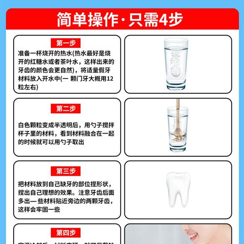 极速门牙牙贴片假牙仿真套牙仿真神器遮盖K牙套仿真吃饭神器防塞