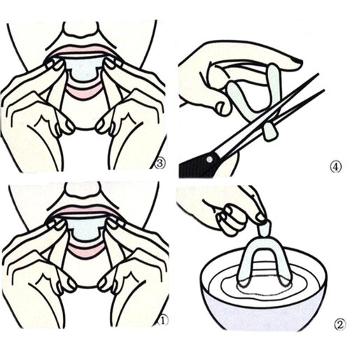 极速10pc Silicone Noight Mouth Guard for Teeth Clenching Gri