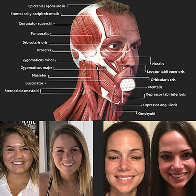 极速Jaw Exerciser Jawline Exerciser GJawline Shaper Face Nec