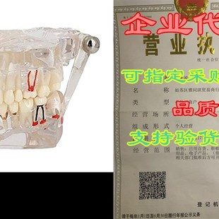 极速Transparent Disease Teethz Model, YOUYA DENTAL Transpare