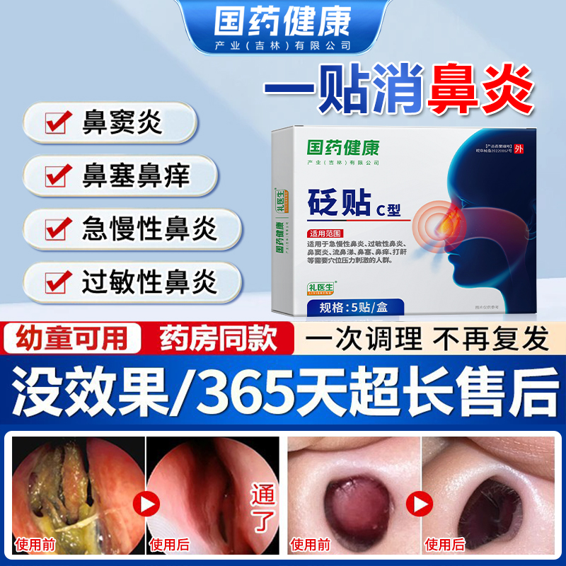国药健康礼医生鼻炎砭贴过敏性急慢性鼻窦炎剂流鼻涕鼻塞鼻痒MM5