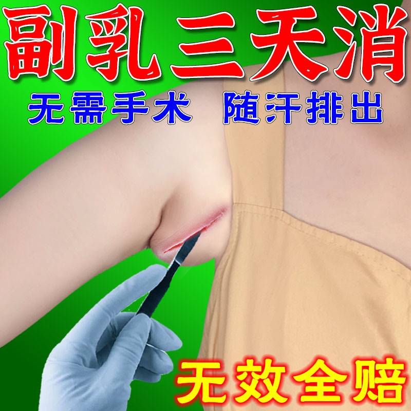 极速副乳贴去副乳神器收副乳消腋下淋巴结S肿大散结疏通贴膏