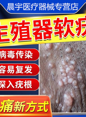 传染性软尤软疣搭配药膏夹子扁平疣病毒去除尤瘊小肉粒一点无尤XQ