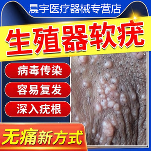 传染性软尤软疣搭配药膏夹子扁平疣病毒去除尤瘊小肉粒一点无尤XQ