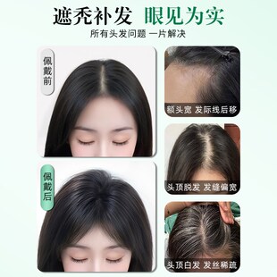 极速假发片女头顶增发量蓬松高颅顶F真发遮白发自然轻薄透气刘海