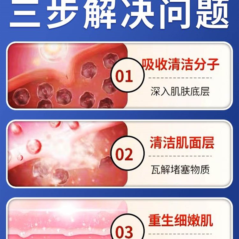速发毛周角化症鸡皮肤疙瘩毛囊膏化药角去除腿童手臂儿上角质消除