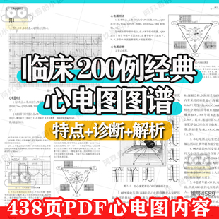 临床200例经典心电图异常诊断图谱心电图特点诊断解析住院医师