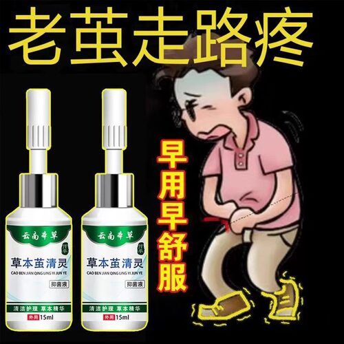 云南本草草本茧清灵老茧手茧脚茧脚底手部茧净死皮根立硬软化剂
