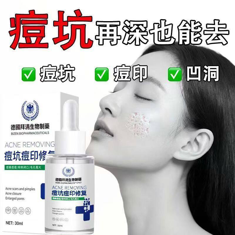 正品德国痘印痘坑修护受损肌肤官方正品红肿凹洞修复淡化痘疤男女