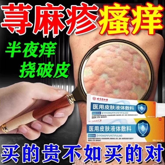 北京同仁堂治疗寻荨麻疹的特效药过敏止痒断根牛皮癣银屑病体股藓皮肤病止痒抑菌湿疹慢急胆碱性专用药膏提高免疫力