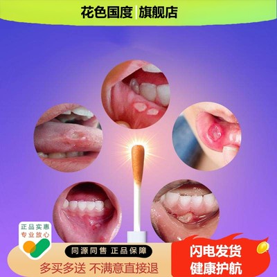 诚达口腔溃烂棉棒棒一点灵口珍舒液体伤口敷料雅口康口腔抑菌液