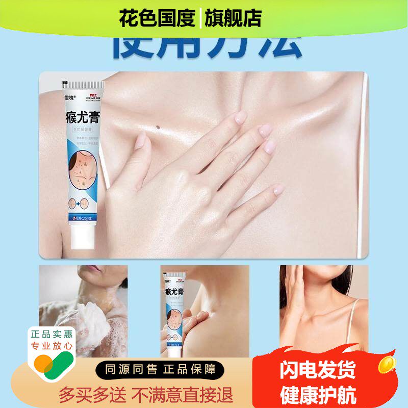 官方正品雪槐瘊尤膏草本克疣膏扁平赘尤肉刺瘊子肉粒瘊尤膏克疣膏