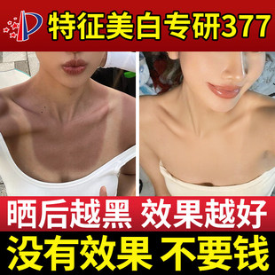太阳晒黑修复变白快速专用皮肤身体脖子军训晒伤了晒后修复霜