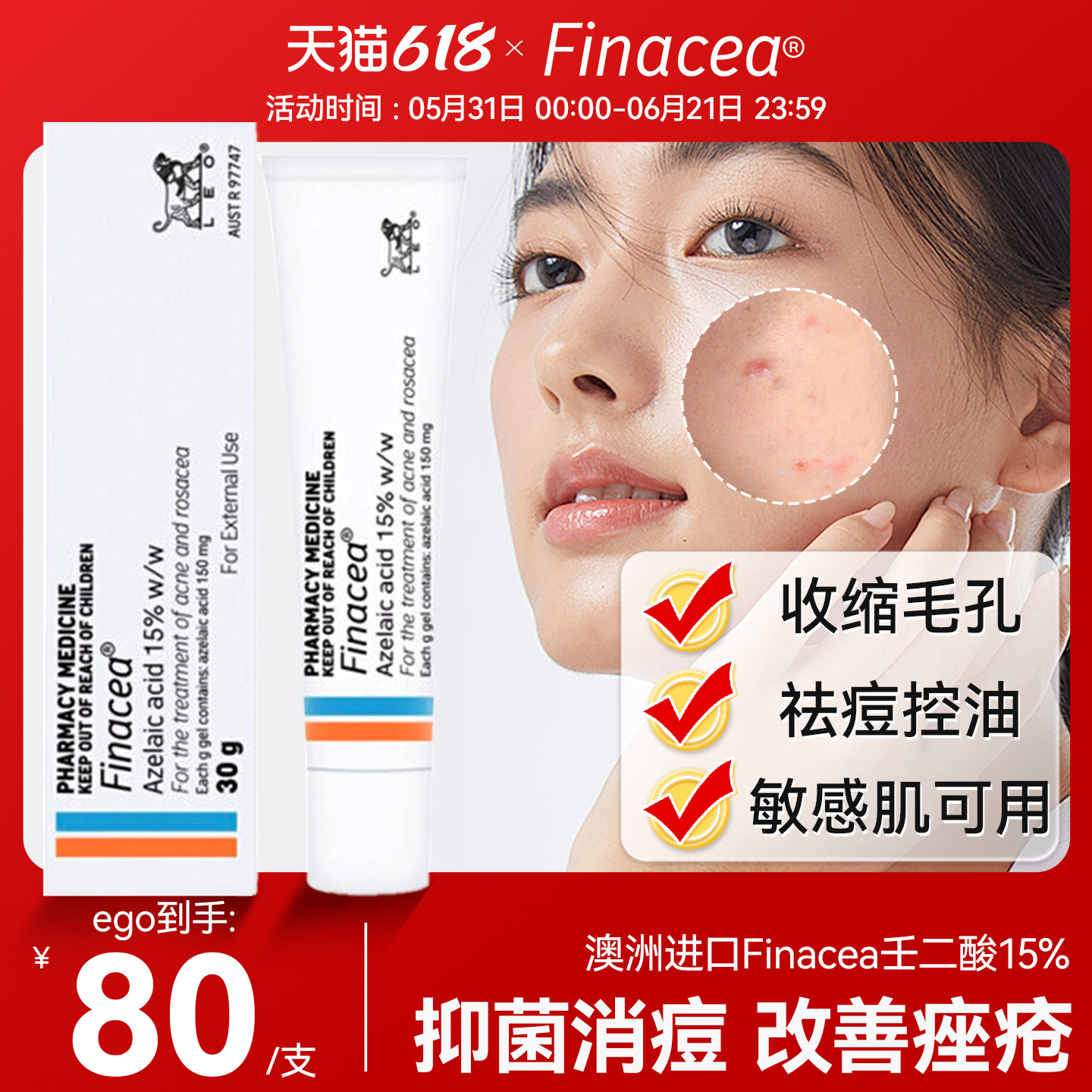 澳洲Finacea15%壬二酸祛痘软膏凝胶医用祛痘膏治疗痤疮乳膏思丽安