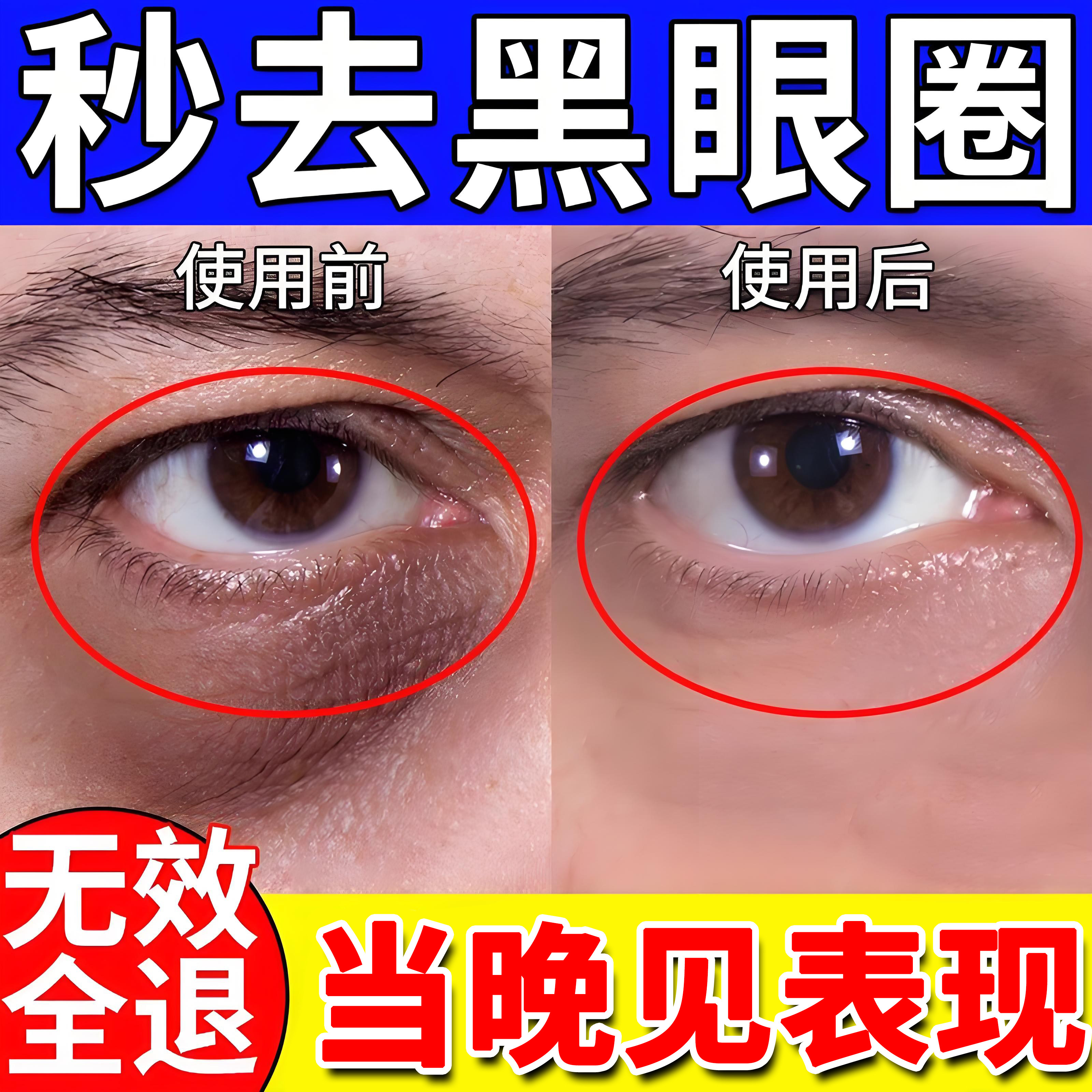 眼疲劳黑眼圈900%包治好】同仁堂