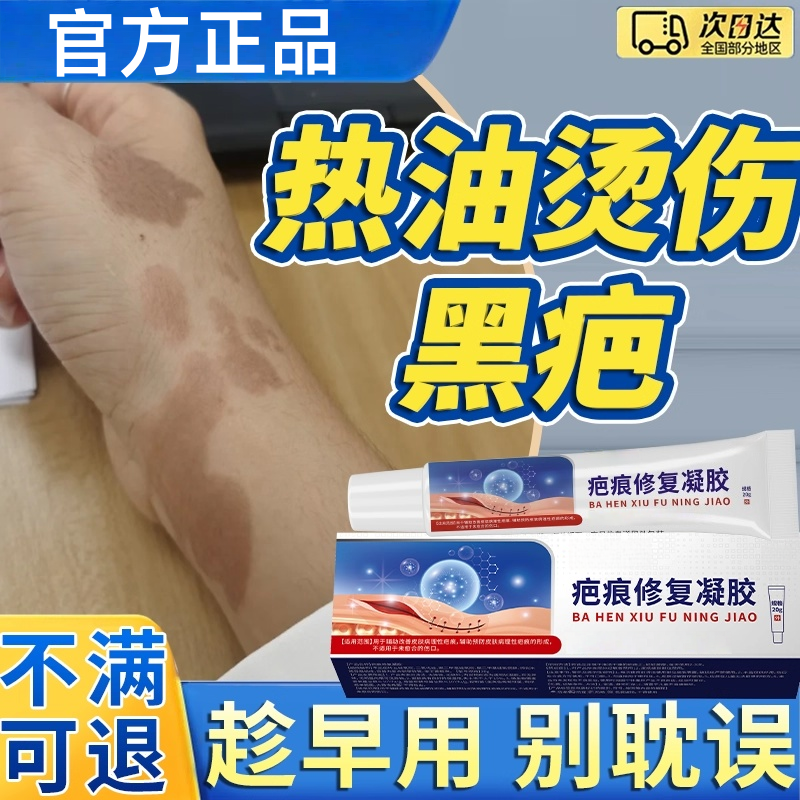油溅被热油烫伤去疤膏疤痕修复去黑色素沉淀烧伤膏去除印痕黑印