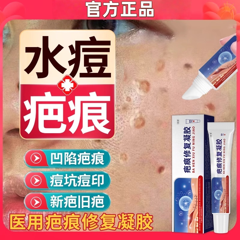 水痘疤痕修水痘坑痘印复凹洞可搭配生长因子祛陷疤膏儿童孩成人