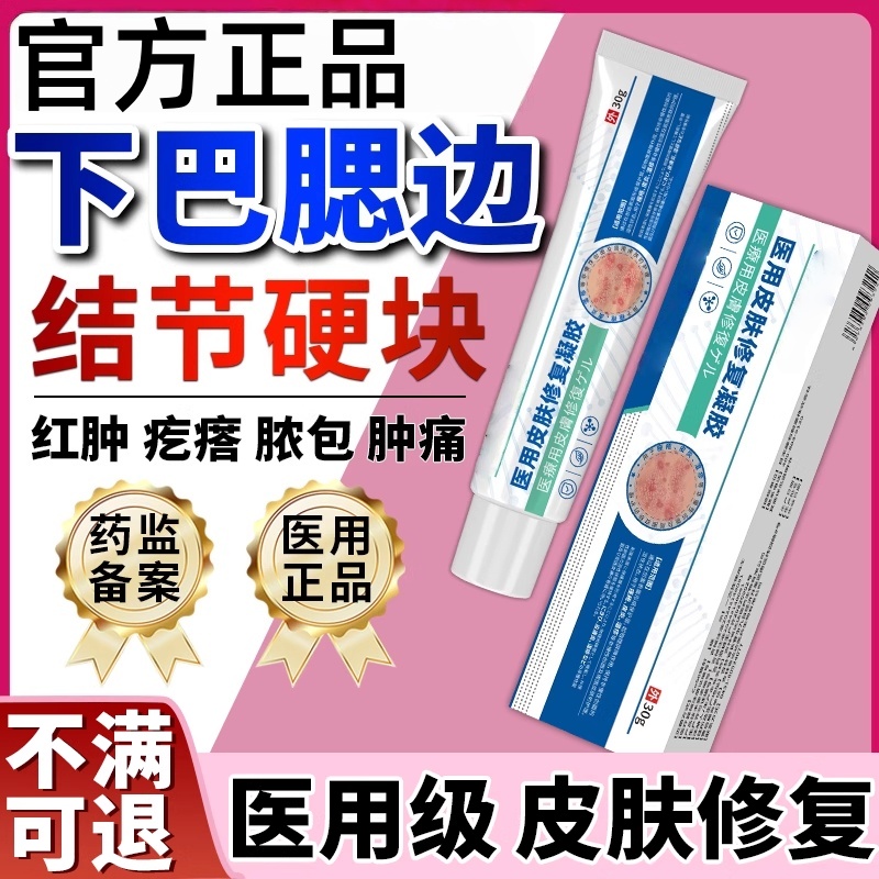 下巴痤疮结节硬块痘反复长痘囊肿腮边淋巴痘疖肿脸用疙瘩脓包