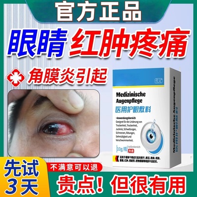 真菌性病毒性角膜炎结膜炎生长因子修复进口熊胆搭滴眼液眼药水