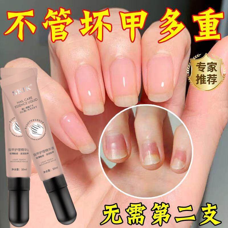 【养出自然真指甲】指甲营养液油增长液修护甲床增厚竖纹防断KJ