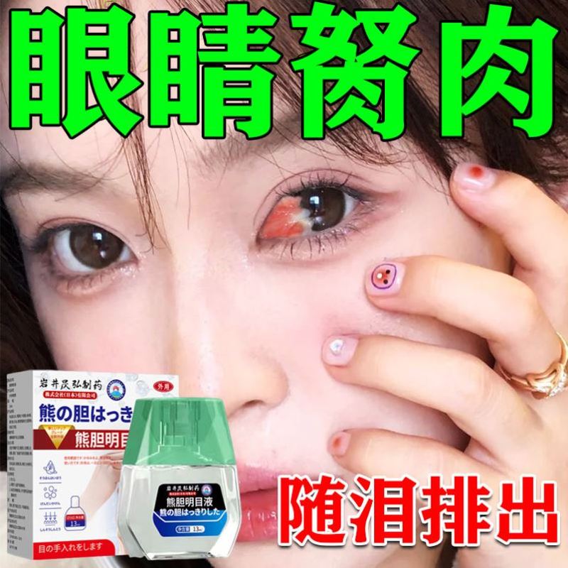 去除眼睛胬肉滴眼液长胬肉有异物感看不清翼状胬肉浑浊红血丝药膏