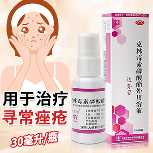 达芬蓉克林霉素磷酸酯外用溶液消炎药痤疮祛痘痘印外用药膏正品